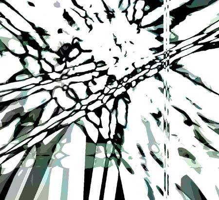 NETZ